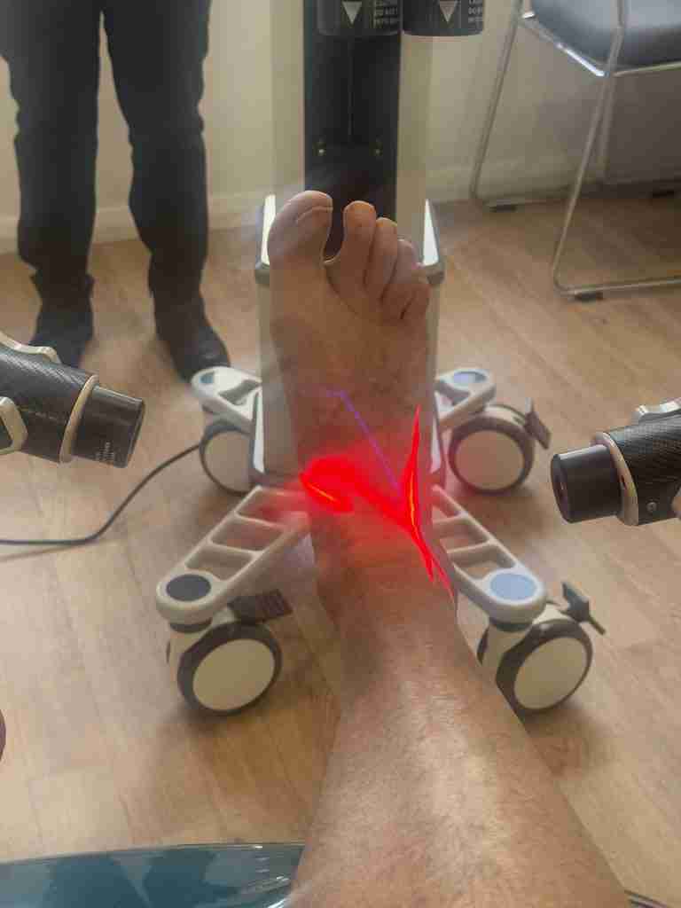 Laser Therapy for peripheral and small fibre neuropathy